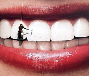 Полировка зубов